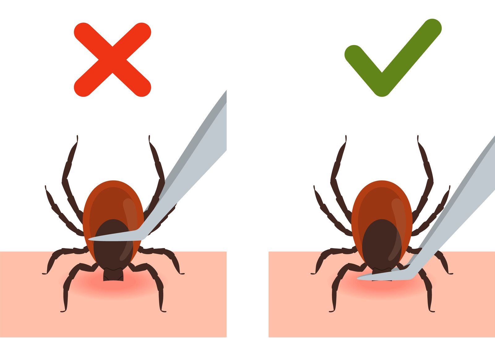 how-to-remove-a-tick-properly-and-avoid-ticks-to-start-with